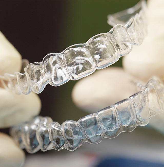 Invisalign Clear Braces Etobicoke ON - Benefits Of Invisalign